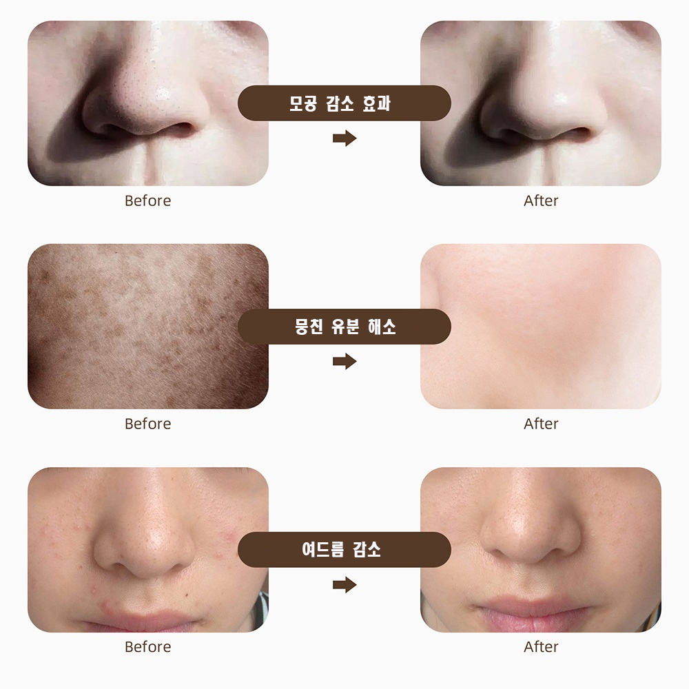 K02 크레오파트라 LED  마스크